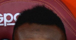 Exclusive: I Will Come Back Strong – Nura Abdullahi Urges His Supporters To Stay Calm And Still Believe In Him, Despite Heart Issues