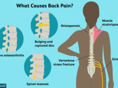 In Good Shape: What Is Causing This Back Pain? By Dr kolade kolapo