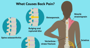 In Good Shape: What Is Causing This Back Pain? By Dr kolade kolapo