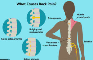 In Good Shape: What Is Causing This Back Pain? By Dr kolade kolapo