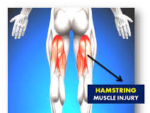 In Good Shape: Understanding Hamstring injury – By Dr. Kolade Kolapo