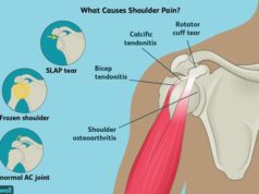 In Good Shape: Shoulder Pain And Problems Key Points – By Dr. Kolade Kolapo