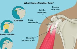 In Good Shape: Shoulder Pain And Problems Key Points – By Dr. Kolade Kolapo