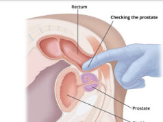 Inflammatory Prostatitis In Nigerian Athletes: What Every Sportsman Should Know
