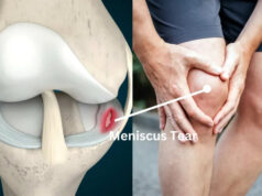 Knee Injuries On The Rise: What Athletes, Coaches Need To Know