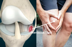 Knee Injuries On The Rise: What Athletes, Coaches Need To Know