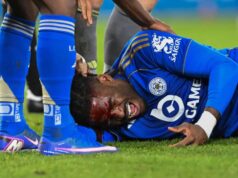 Leicester City Defender Caleb Okoli Suffers Bloody Cut After Clash Of Heads