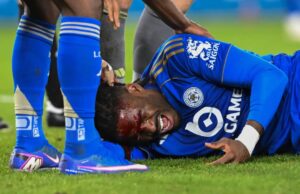 Leicester City Defender Caleb Okoli Suffers Bloody Cut After Clash Of Heads